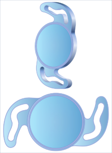 Two intraocular lenses (IOLs,) such as PanOptix