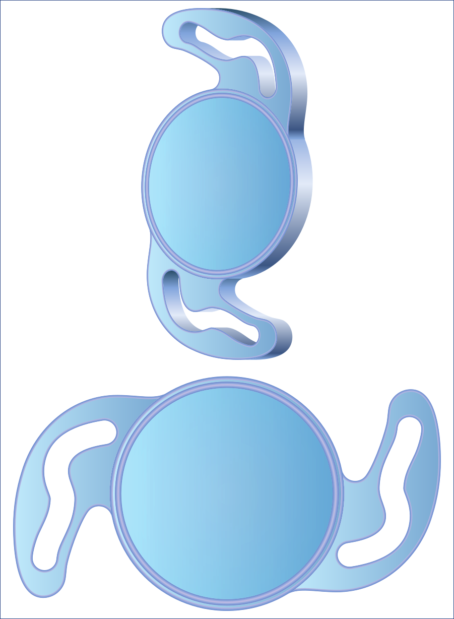 Two intraocular lenses (IOLs,) such as PanOptix